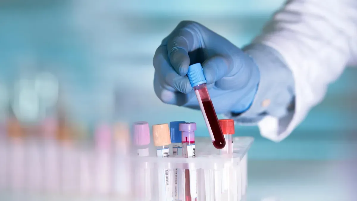 Blood test for Crohn's disease detection showing antibodies to gut bacteria
